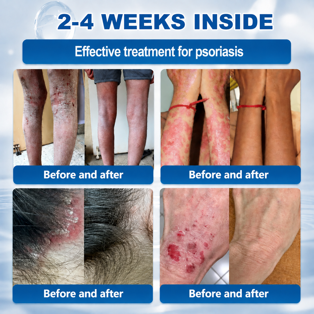 𝐇𝐞𝐚𝐥𝐫𝐢𝐳𝐞® 𝟕-𝐃𝐚𝐲 𝐒𝐤𝐢𝐧 𝐓𝐚𝐠 & 𝐒𝐩𝐨𝐭 𝐄𝐫𝐚𝐬𝐞𝐫 𝐂𝐫𝐞𝐚𝐦 (𝐙𝐞𝐫𝐨 𝐏𝐚𝐢𝐧, 𝐙𝐞𝐫𝐨 𝐒𝐜𝐚𝐫𝐬 𝐅𝐨𝐫𝐦𝐮𝐥𝐚)💎💎💎💎