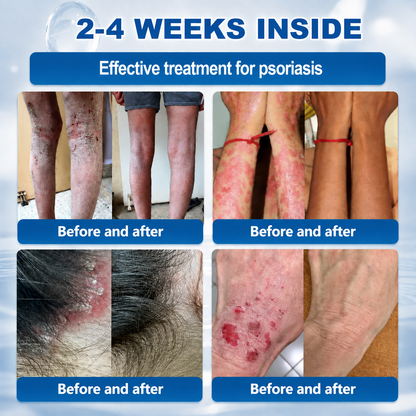 𝐇𝐞𝐚𝐥𝐫𝐢𝐳𝐞® 𝟕-𝐃𝐚𝐲 𝐒𝐤𝐢𝐧 𝐓𝐚𝐠 & 𝐒𝐩𝐨𝐭 𝐄𝐫𝐚𝐬𝐞𝐫 𝐂𝐫𝐞𝐚𝐦 (𝐙𝐞𝐫𝐨 𝐏𝐚𝐢𝐧, 𝐙𝐞𝐫𝐨 𝐒𝐜𝐚𝐫𝐬 𝐅𝐨𝐫𝐦𝐮𝐥𝐚)💎💎💎💎