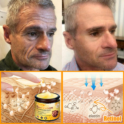Made and Shipped from USA ✨ VLSVLS® Bee Venom Skin Restoration Cream 🌸 Anti-aging,Hydrating, Skin Repair, Even Tone, Acne and Dark Spot Treatment, Wart and Mole Removal, Psoriasis Relief 🔥 LAST DAY 80% OFF 💎