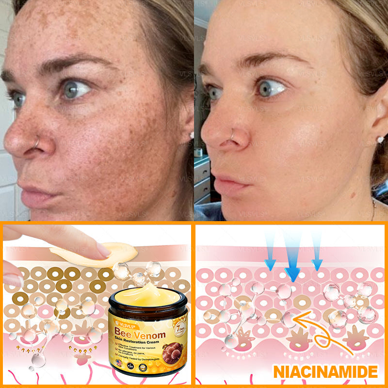 Made and Shipped from USA 🎇 VLSVLS® Bee Venom Skin Restoration Cream 🔥 LAST DAY 80% OFF☘️☘️