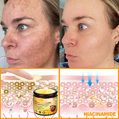 Made and Shipped from USA 🎇 VLSVLS® Bee Venom Skin Restoration Cream 🔥 LAST DAY 80% OFF☘️☘️
