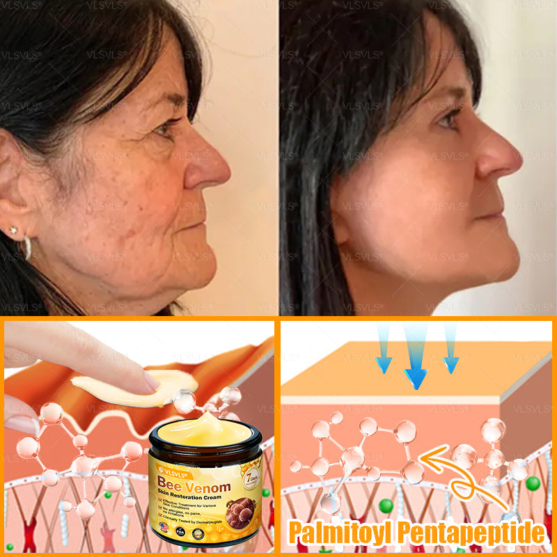 Made and Shipped from USA 🎇 VLSVLS® Bee Venom Skin Restoration Cream 🔥 LAST DAY 80% OFF☘️☘️