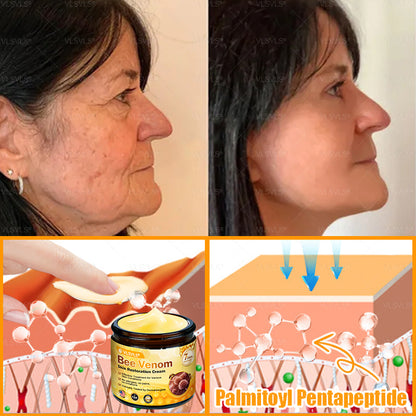 Made and Shipped from USA 🎇 VLSVLS® Bee Venom Skin Restoration Cream 🔥 LAST DAY 80% OFF☘️☘️