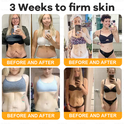 Made and Shipped from USA ✨ VLSVLS® Bee Venom Skin Restoration Cream 🌸 Anti-aging,Hydrating, Skin Repair, Even Tone, Acne and Dark Spot Treatment, Wart and Mole Removal, Psoriasis Relief 🔥 LAST DAY 80% OFF 💎