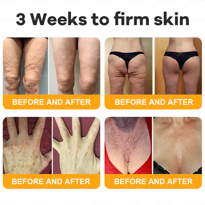 Made and Shipped from USA 🎇 VLSVLS® Bee Venom Skin Restoration Cream 🔥 LAST DAY 80% OFF☘️☘️