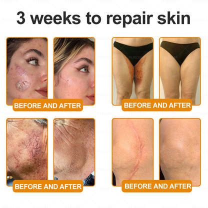 Made and Shipped from USA 🎇 VLSVLS® Bee Venom Skin Restoration Cream 🔥 LAST DAY 80% OFF☘️☘️