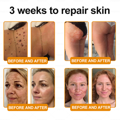 Made and Shipped from USA 🎇 VLSVLS® Bee Venom Skin Restoration Cream 🔥 LAST DAY 80% OFF☘️☘️