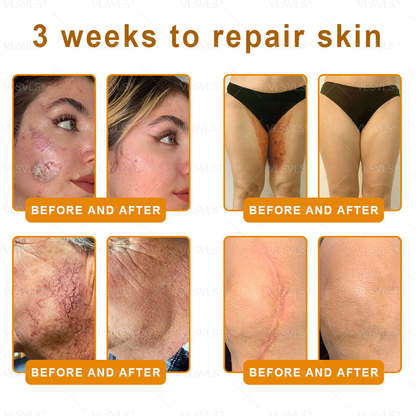 Made and Shipped from USA ✨ VLSVLS® Bee Venom Skin Restoration Cream 🌸 Anti-aging,Hydrating, Skin Repair, Even Tone, Acne and Dark Spot Treatment, Wart and Mole Removal, Psoriasis Relief 🔥 LAST DAY 80% OFF 💎