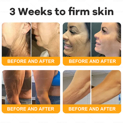 Made and Shipped from USA 🎇 VLSVLS® Bee Venom Skin Restoration Cream 🔥 LAST DAY 80% OFF☘️☘️